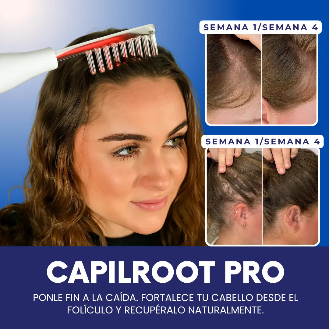 CapilRoot Pro - Recupera tu cabello y tu confianza en casa, sin químicos ni pastillas